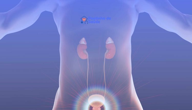 Como se preparar para o exame de Cistoscopia?