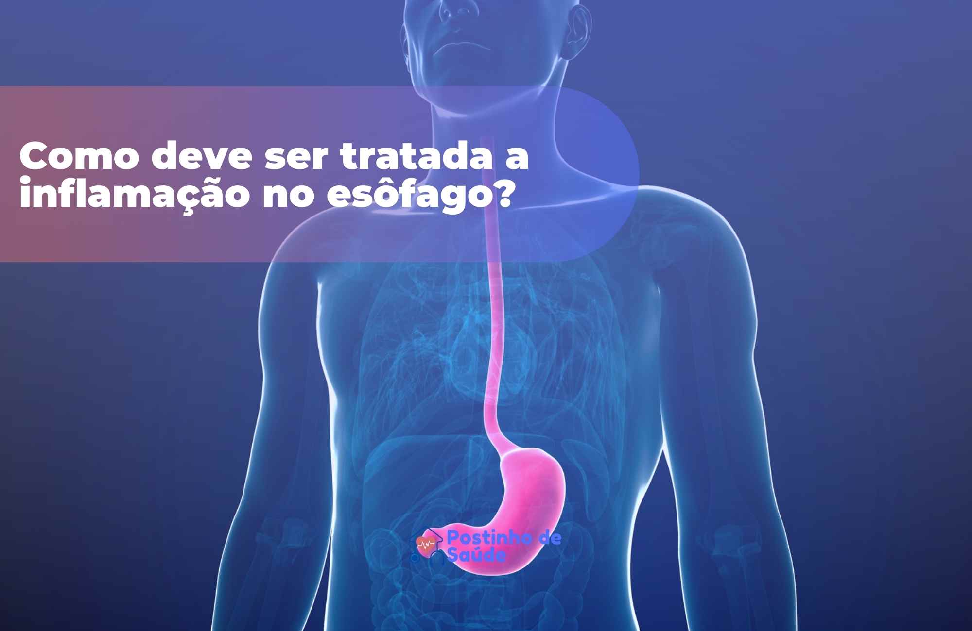 Quais os sintomas de inflamação no esôfago como diagnosticar e tratar Quais os sintomas de inflamação no esôfago como diagnosticar e tratar