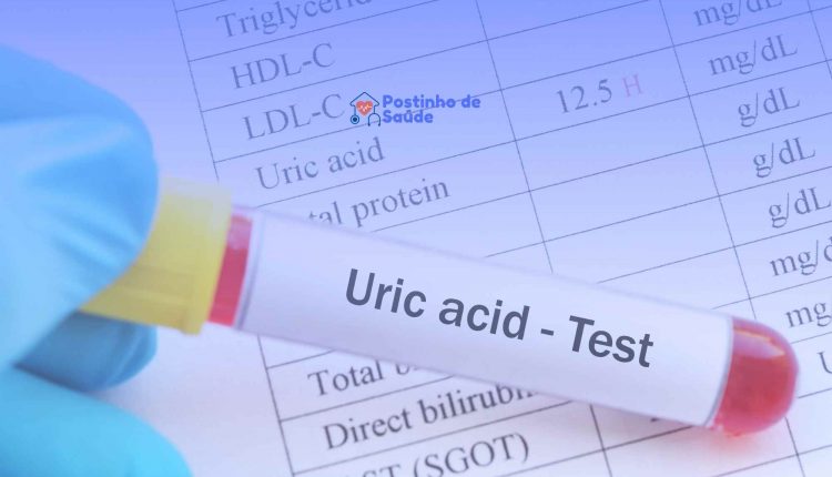 Saiba se quem tem ácido úrico pode comer arroz! Confira!